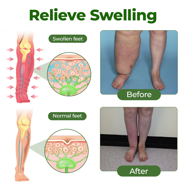 Tiworld® Professional Leg Circulation Cream