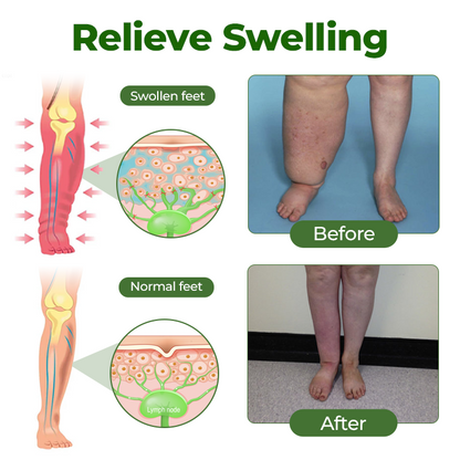 Tiworld® Professional Leg Circulation Cream