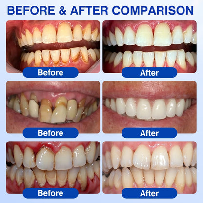 🇨🇦👨‍⚕️🦷🛡️YAGOO® Periodontal Repair Gel