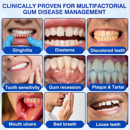 🇨🇦👨‍⚕️🦷🛡️YAGOO® Periodontal Repair Gel
