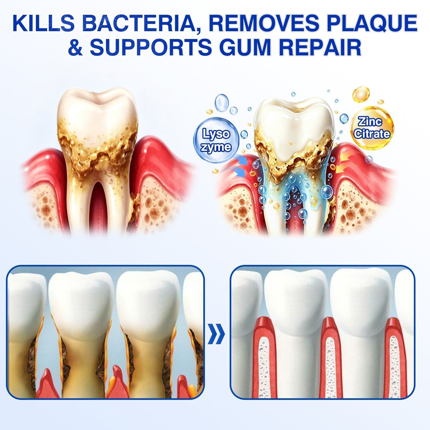 🇨🇦👨‍⚕️🦷🛡️YAGOO® Periodontal Repair Gel