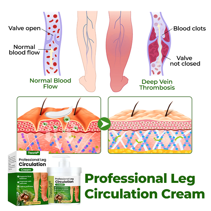 Tiworld® Professional Leg Circulation Cream